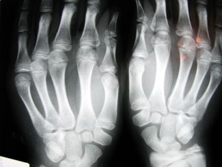 hands